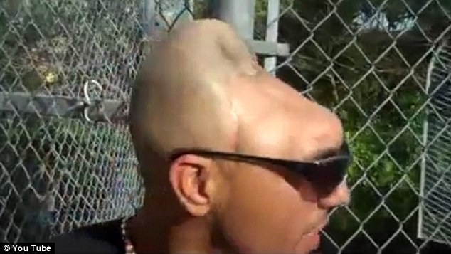 [Pria-ini-Hanya-Memiliki-Setengah-Kepala_2%255B3%255D.jpg]