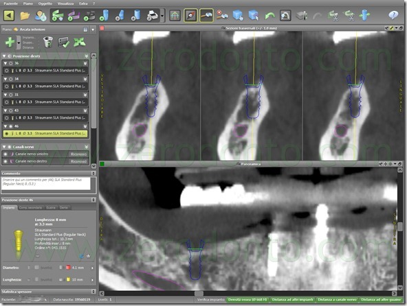 - (68) software codiagnostix