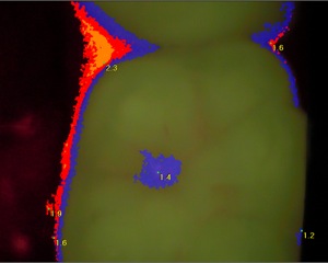 Molar Image 3.jpg