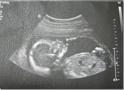 Baby #2 Ultrasound 002