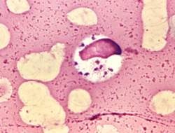 [A%2520busca%2520por%2520medicamentos%2520contra%2520doen%25C3%25A7as%2520sem%2520interesse%2520comercial3%255B3%255D.jpg]