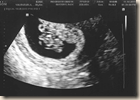 1st ultrasound jpeg