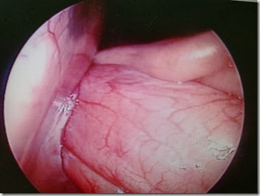 gastropessi preventiva (2) gastropessi preventiva (2)