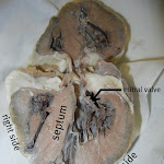 heart_chambers_closer_labeled.JPG