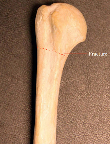 humerus. humerus.