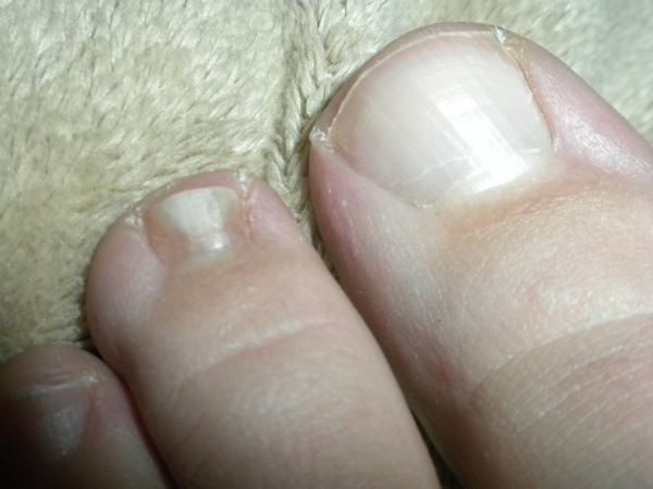 DSCN8581