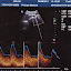 Écoute des flux sanguins Écoute des flux sanguins