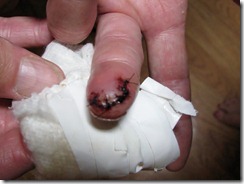2011 07 15 Cut finger