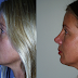 Rhino9.png