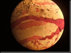 Venous Thrombosis- high resolution histology slide tsnaps Venous Thrombosis- high resolution histology slide tsnaps