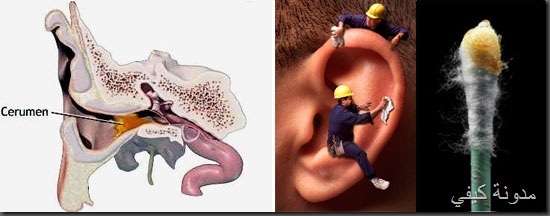 لعلاج مشاكل الاذن علاج الاذن