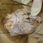brain_dissect01.jpg brain_dissect01.jpg