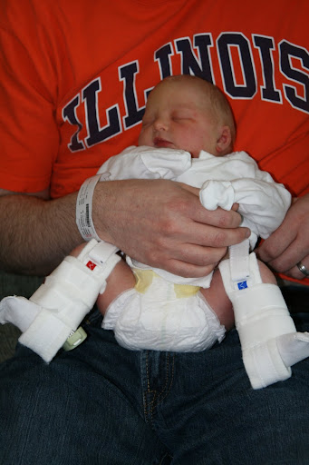Pavlik Harness Pictures