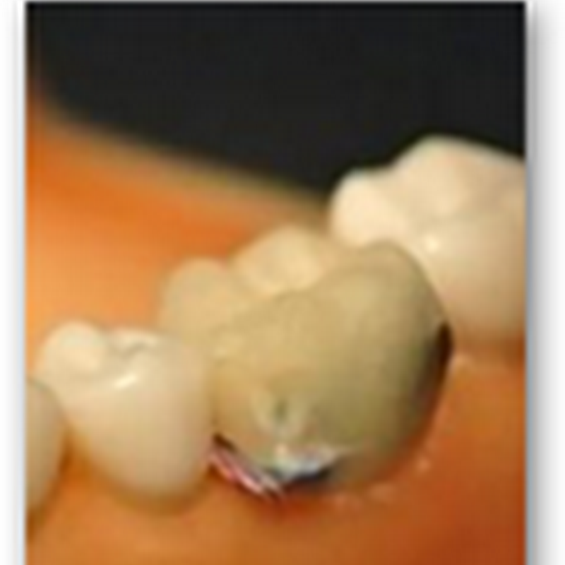 Your Cheating Tooth Will Tell On You..Tracking The Activity In Your Mouth, Who Knows Maybe It Will Send Data About Oral Sex Activities Too…