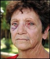 BADENHORST ALET 64 bloodied beaten eyes she and husband Paul 57 ATTACKED AT SKEERPOORT.jpghusband