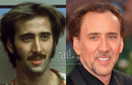 La caida del pelo de Nicolas Cage