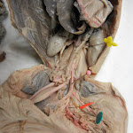 fetal_pig_common_iliac.JPG