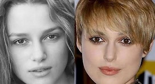[keira-knightley-before-after%2520plastic%2520surgery%255B3%255D.jpg]
