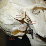 skull_styloid_process_labeled.JPG