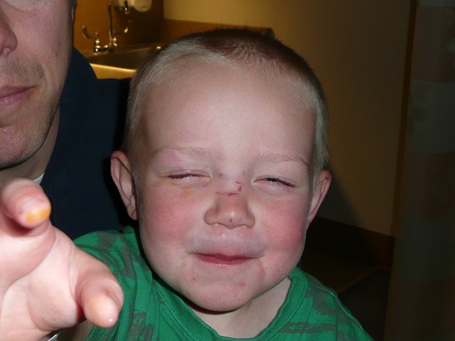 [eye%2520injury%2520009%255B4%255D.jpg]