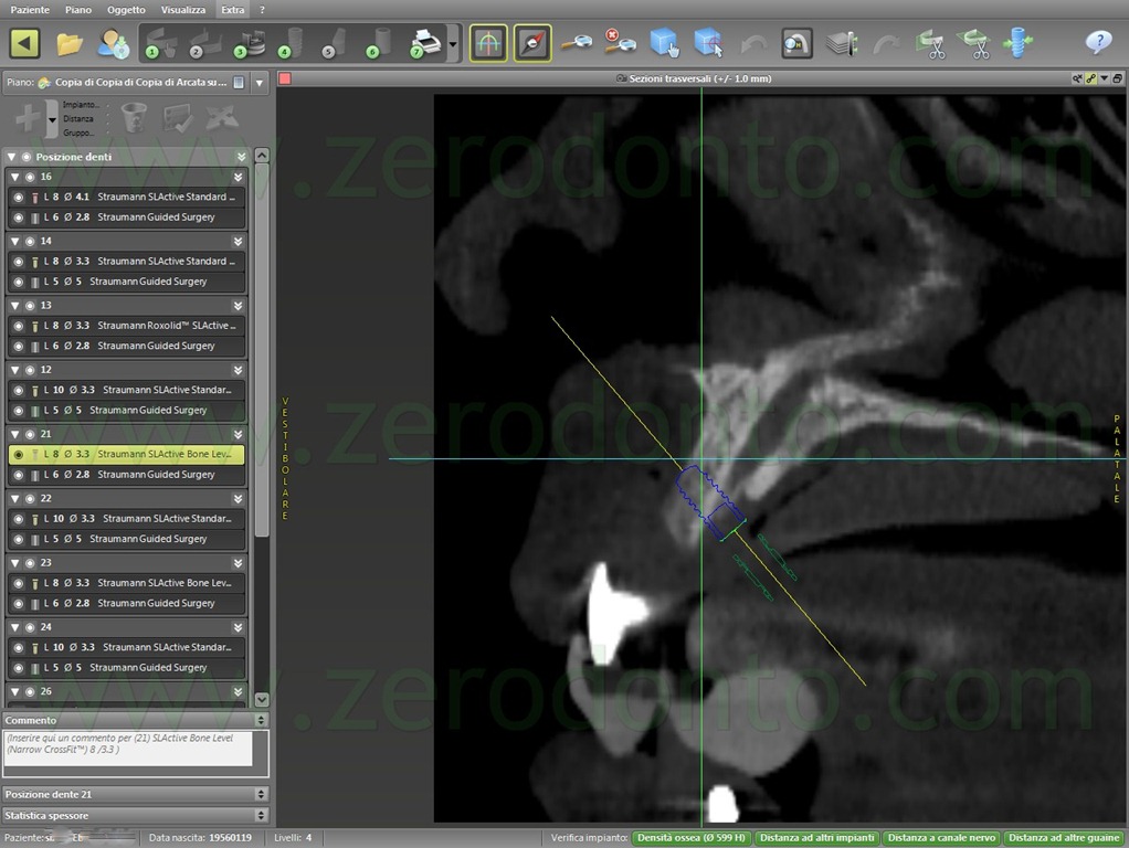 [--86-pin-di-stabilizzazione6.jpg]