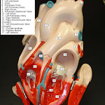 heart_model_04_answers.jpg heart_model_04_answers.jpg