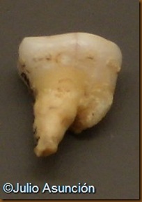 Molar humano de Alkerdi - Urdax - Museo de Navarra