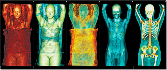 Des visions fascinantes du corps humain