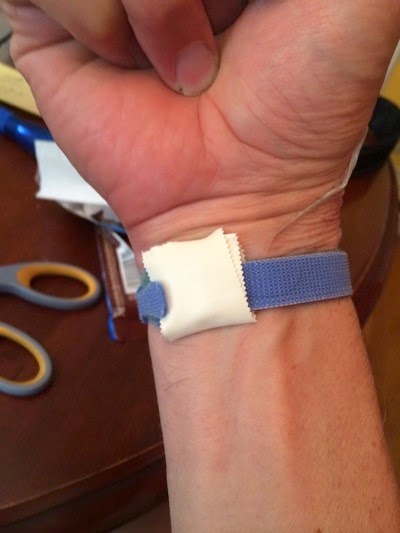 Ganglion Cyst Splint 4