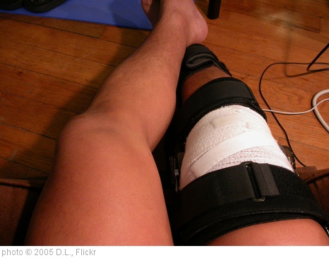 'my knee in a brace' photo (c) 2005, D.L. - license: http://creativecommons.org/licenses/by-sa/2.0/