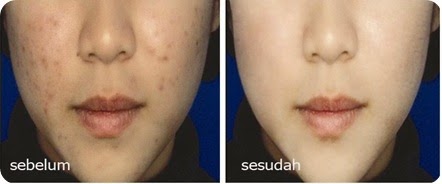 before-after copy before-after copy