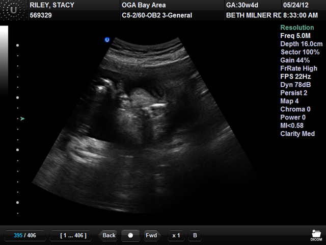 [3rd%2520TriMester%2520031%255B3%255D.png]