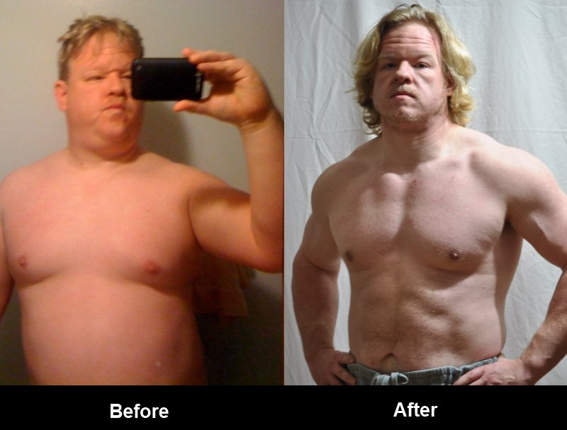 [BeforeAfter_FAngleMed%255B1%255D.jpg]