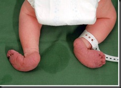 rocking bottom feet newborn