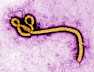 Fakta-fakta Mengenai Ebola Yang Perlu Diketahui