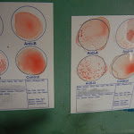 blood_type_compare.JPG
