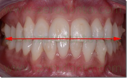 Fig. 21 Fig. 21