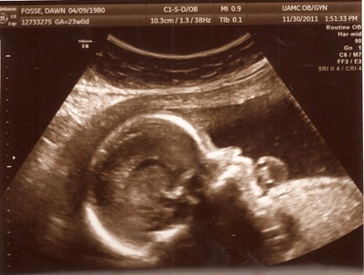 child #4 ultrasound 1