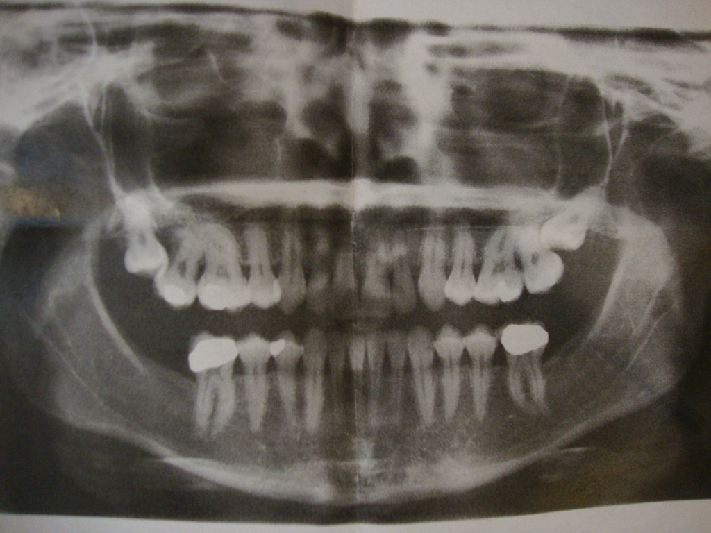 [China%2520Clayton%2520Cut%2520413.jpg]