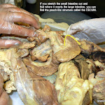 cecum_L.JPG