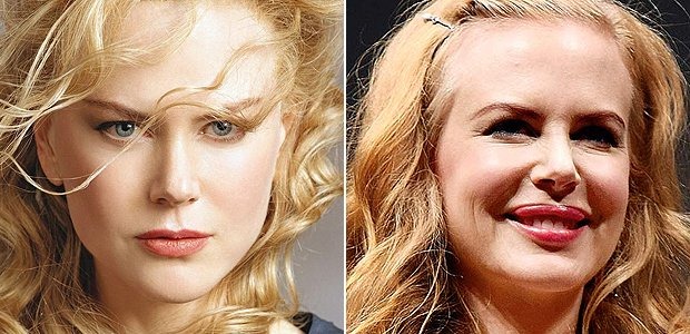 Nicole Kidman Nicole Kidman