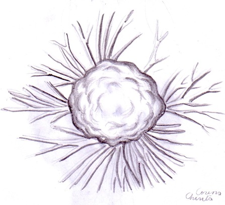 Celula canceroasa Celula canceroasa