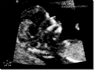 12 weeks profie of head