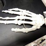 hand_metacarpals_unlabeled.JPG