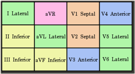 325px-Contiguous_leads