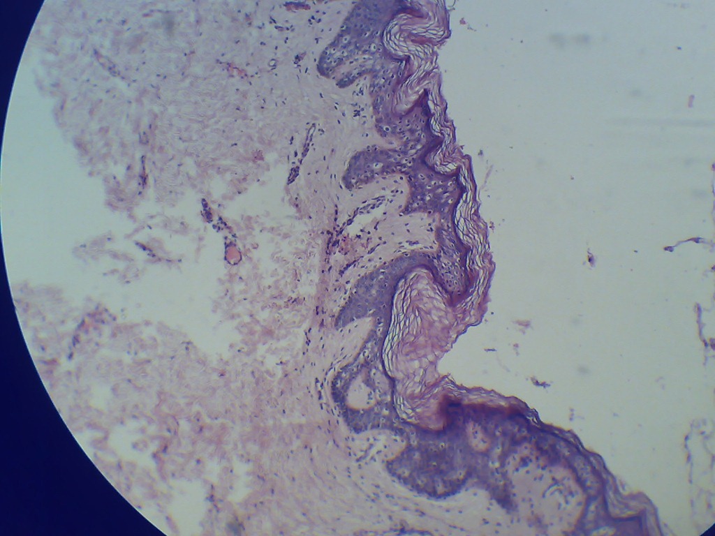[Stratified%2520squamous%2520keratinized%2520epithelium%2520the%2520magnified%2520microscopy%255B4%255D.jpg]