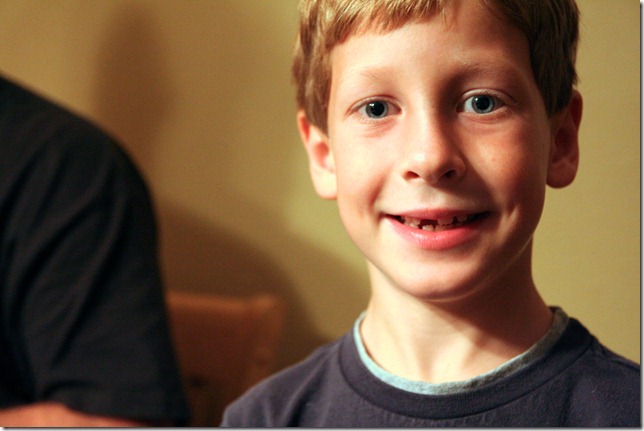 2011 11 04_Sean's missing tooth 2011 11 04_Sean's missing tooth