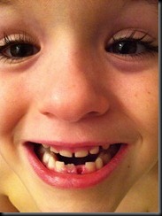 lost tooth lost tooth