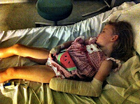 Ready to go home with a splint and temporary cast.