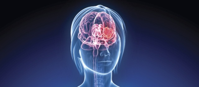[cerebro%2520femenino%255B4%255D.jpg]